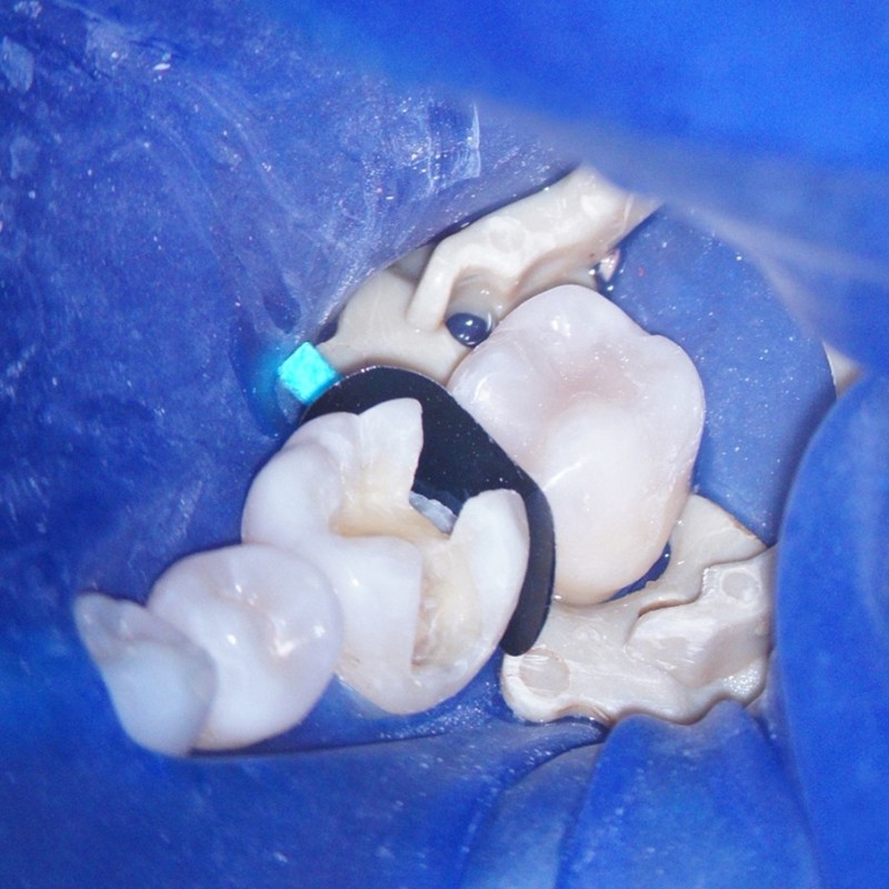 Quickmat LumiContrast paski gr. 0,025 mm. 6735, 6736 ОП.70 шт.