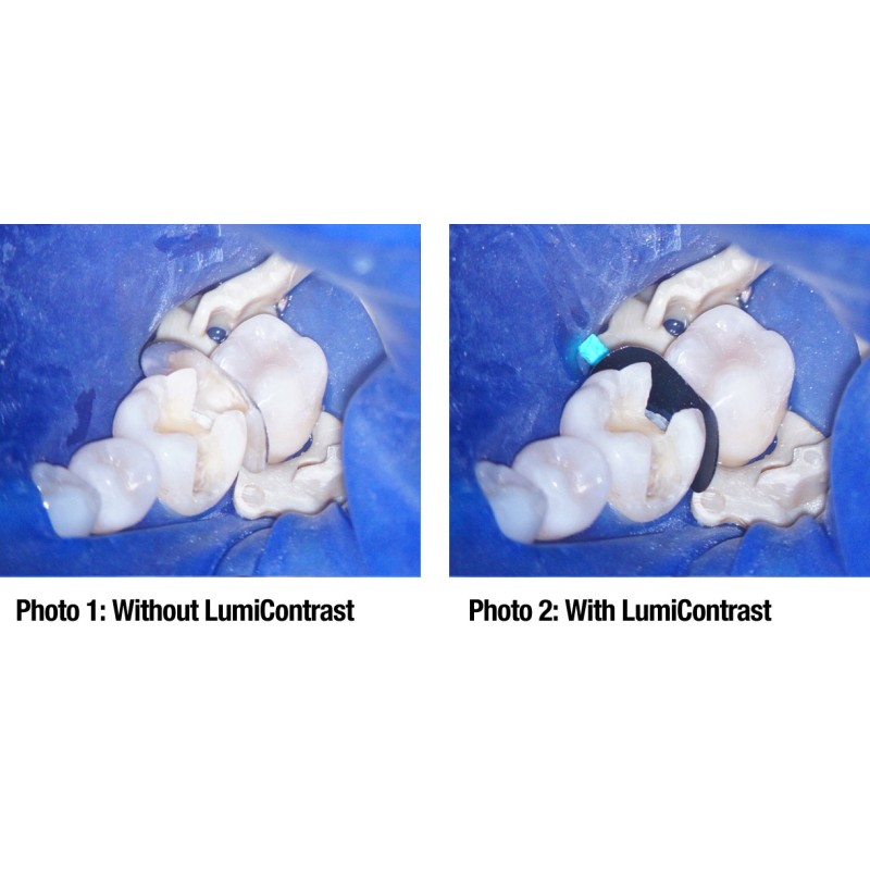 Quickmat LumiContrast paski gr. 0,025 mm. 6735, 6736 ОП.70 шт.