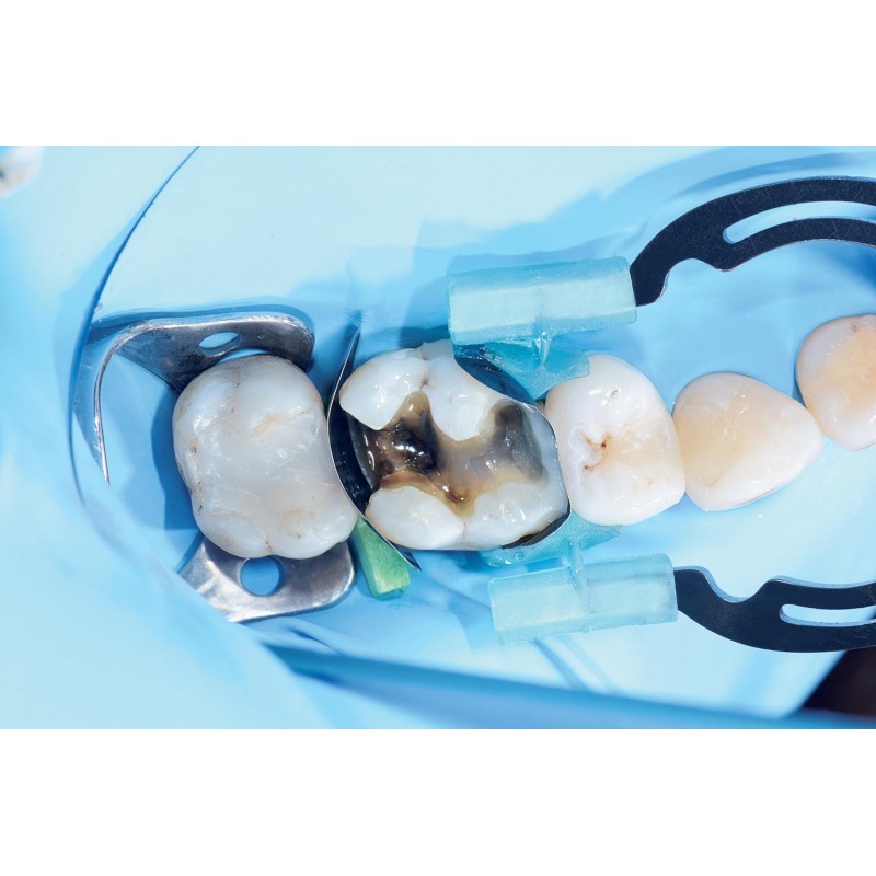 MyTines-zaciski do MyClip i MyRing Forte op. 6 par Polydentia