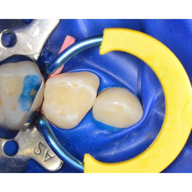 MyJunior Kit 6330 комплект Polydentia